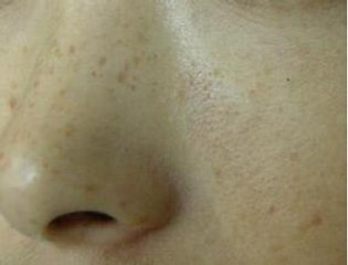 月經(jīng)疾病的形成的因素有哪些